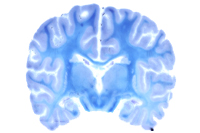 znp_misc_brain1_white