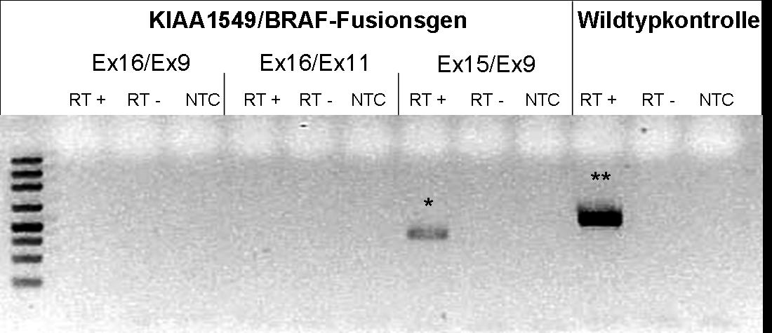 ng_braf-fusionsgen